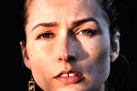 eczema and the cold sore virus