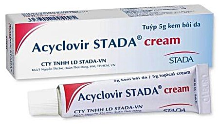 How to use Acyclovir cream for cold sores